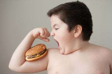 Tratamiento de la obesidad en los niños Tratamiento de la obesidad en los niños