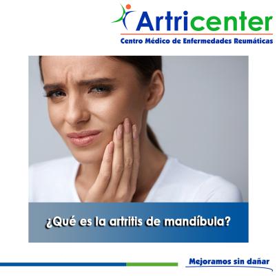 Artricenter: ¿Qué es la artritis de mandíbula?