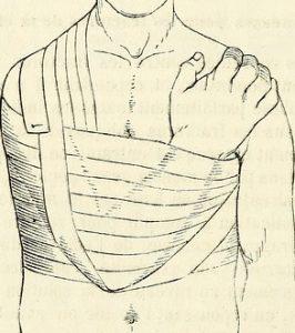 velpeau vendaje 2 velpeau vendaje 2