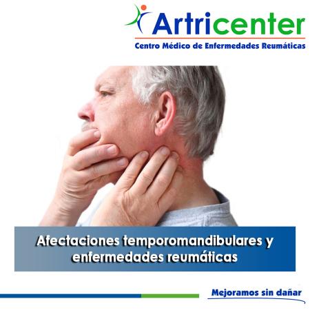 Artricenter: Afectaciones temporomandibulares y enfermedades reumáticas