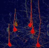 Uso de la  Terapia Génica para recuperar la Funcionalidad del Cerebro