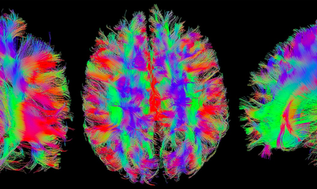 Captura de Pantalla 2019-09-12 a la(s) 10.32.19 Excesiva conectividad entre dos redes cerebrales se asocia con la ira y la agresión