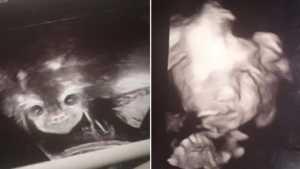 Se hizo una ecografía y la foto la horrorizó: “Tengo al diablo adentro”