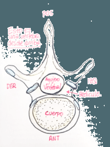 ¿Que es la compresión medular y/o radicular?