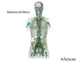 LINFOMA - EL CÁNCER DEL TEJIDO LINFÁTICO ES MÁS COMÚN EN EDADES DE 15 A 35 Y DE 50 A 70 AÑOS