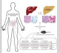 Vinculan las Bacterias Intestinales con el Hígado Graso no Alcohólico