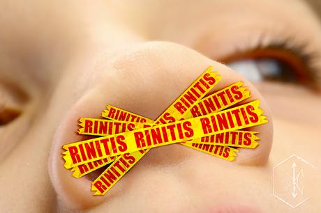 Rinitis vasomotora y su tratamiento