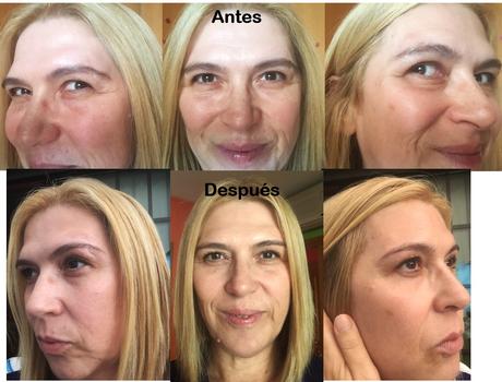 Experiencia: Lifting de pestañas en Sundara