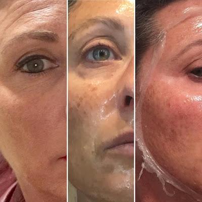 Viernes de Spa + Rutina Nocturna, mascarilla de colágeno, luckyfine