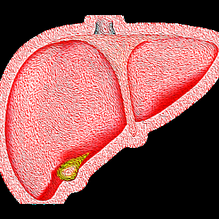 enfermedad de hígado graso