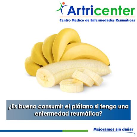 Artricenter:¿Es bueno consumir el plátano si tengo una enfermedad reumática?