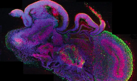 Desarrolo de cerebros humanos: ¿científicos cruzan la linea ética?