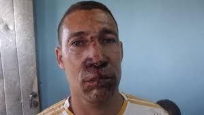 José Daniel Ferrer: Preso por pandillero y camorrista