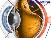 Causas desprendimiento retina