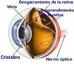desprendimientoretina Causas del desprendimiento de retina
