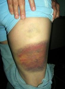 Honduras: resumen de noticias