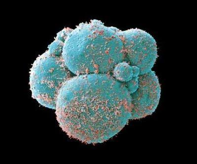 DIAGNÓSTICO PREIMPLANTACIONAL DE LA LUDOPATÍA