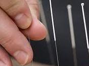 acupuntura puede ayudar embarazo