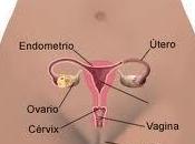 ¿Qué vaginitis?