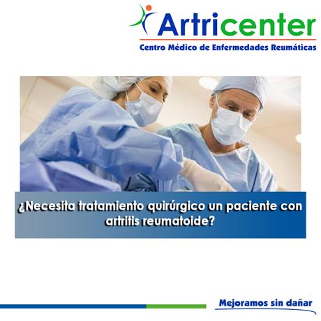 Artricenter: ¿Necesita tratamiento quirúrgico un paciente con artritis reumatoide?