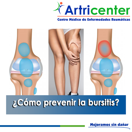 Artricenter: ¿Cómo prevenir la bursitis?