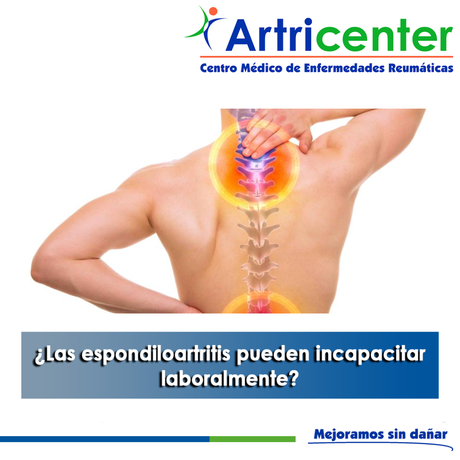 Artricenter: ¿Las espondiloartritis pueden incapacitar laboralmente?