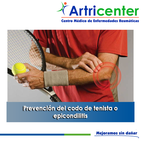 Artricenter: Prevención del codo de tenista o epicondilitis