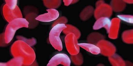 CRISPR/Cas9: laboratorios afirman haber curado pacientes con enfermedades hereditarias de sangre CRISPR/Cas9: laboratorios afirman haber curado pacientes con enfermedades hereditarias de sangre