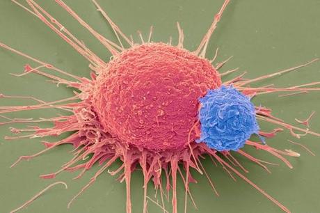 CRISPR/Cas9: laboratorios afirman haber curado pacientes con enfermedades hereditarias de sangre CRISPR/Cas9: laboratorios afirman haber curado pacientes con enfermedades hereditarias de sangre