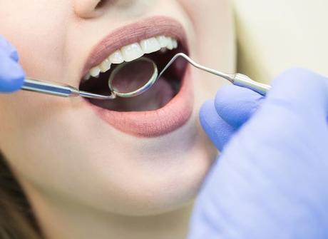 6 ventajas de prescindir del pegamento dental para la dentadura postiza - Trucos de salud caseros