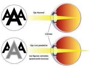 Que es Presbicia y daltonismo (ojo ocular)