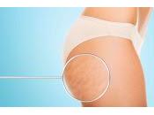 celulitis grasa mismo?