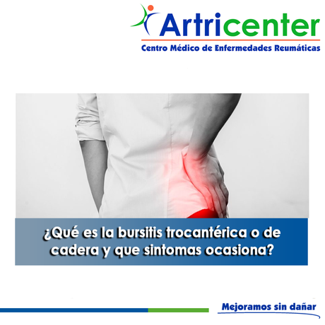 ¿Qué es la bursitis trocantérica o de cadera y que sintomas ocasiona?