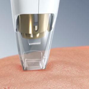 Los mejores tratamientos express para Navidad Los mejores tratamientos express para Navidad