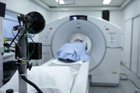 Nueva tecnología de resonancia magnética prueba anomalías cerebrales en la depresión