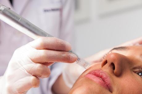 Tratamientos Estéticos para Lucir Radiantes en Navidad dermapen