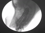 bebe perro visto Rayos-X