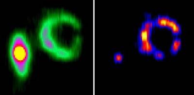 Sistema ARP 147, colisión estelar entre galaxias