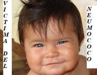 Meningitis por meningococo