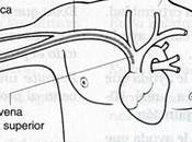 Profilaxis antibiótica colocación puertos acceso venoso central