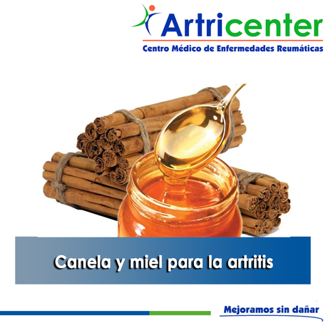 Artricenter: Canela y miel para la artritis
