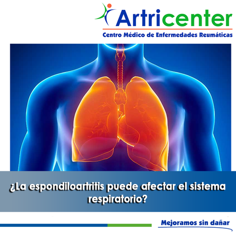 Artricenter: ¿La espondiloartritis puede afectar el sistema respiratorio?