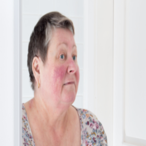 ¿Sabes cómo se quitan las antiestéticas venas de la cara con láser?