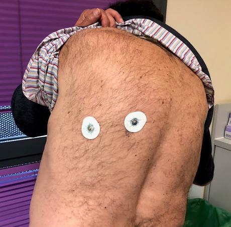 El electro de antaño...