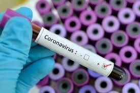 Coronavirus: alerta, no alarma