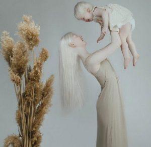 Hermanas albinas con 12 años de diferencia deleitan a todo Internet con sus fotos