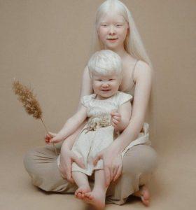 Hermanas albinas con 12 años de diferencia deleitan a todo Internet con sus fotos