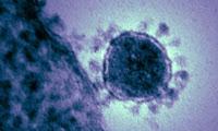 Evalúan Fármacos experimentales para tratar el nuevo coronavirus