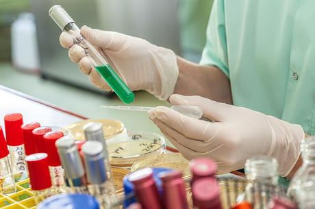 Investigaciones La Enfermedad De Parkinson