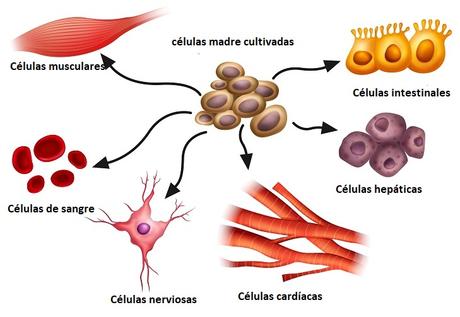 Aplicaciones de células madre humanas Parkinson